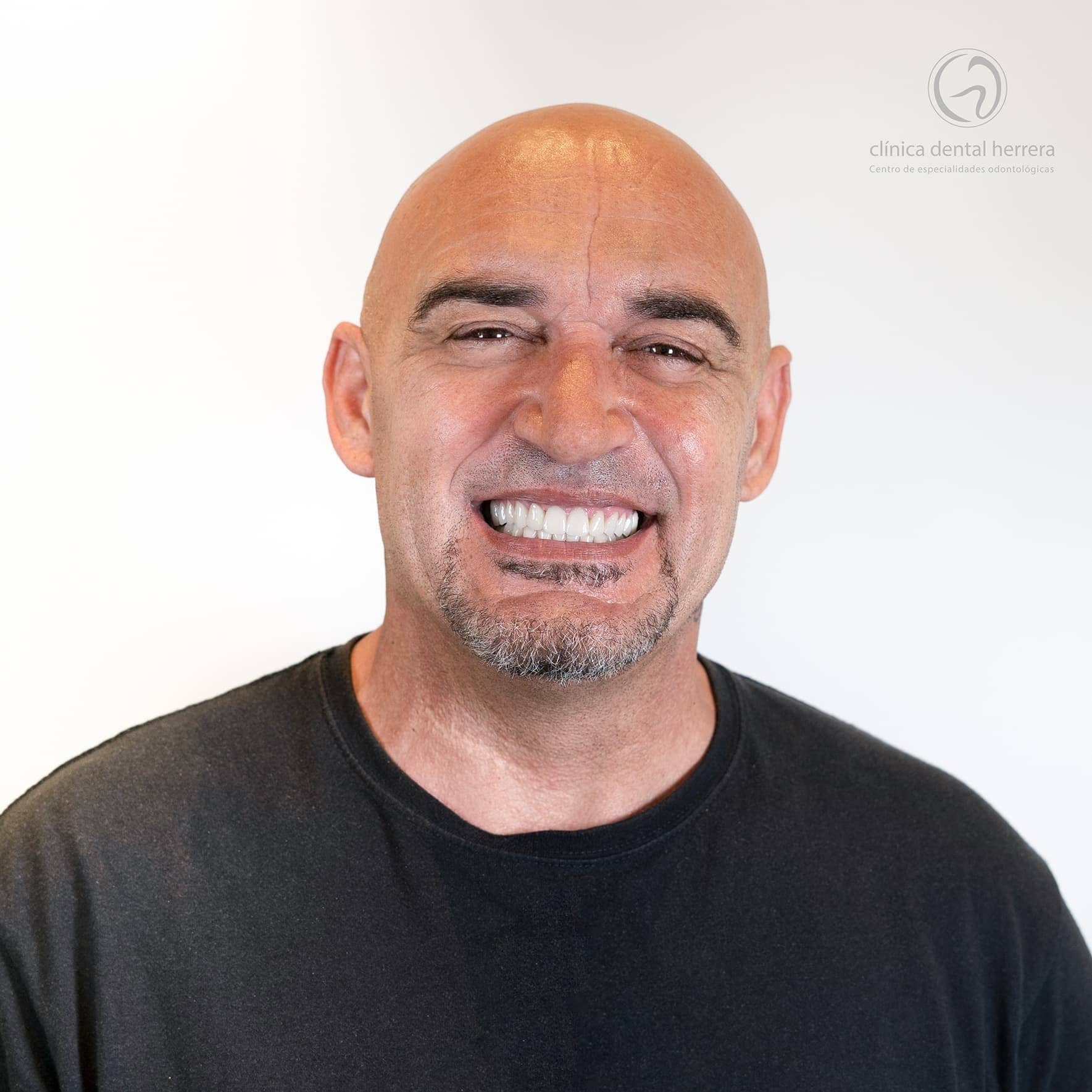 Antonio Díaz Ortega. Invisalign, Veneers and Dental Crowns 3